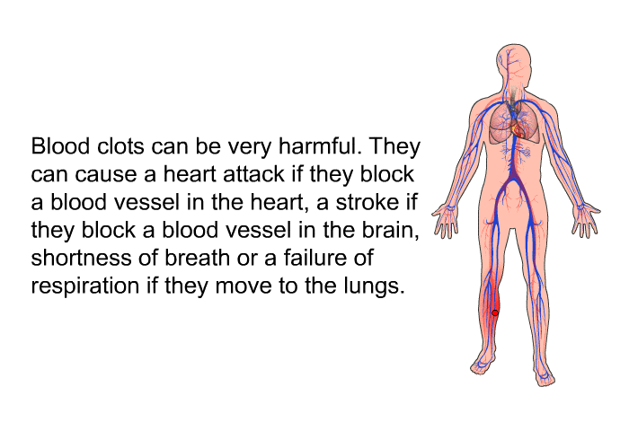Blood clots can be very harmful. They can cause a heart attack if they block a blood vessel in the heart, a stroke if they block a blood vessel in the brain, shortness of breath or a failure of respiration if they move to the lungs.