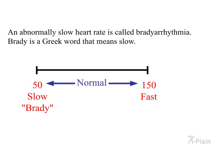An abnormally slow heart rate is called bradyarrhythmia. Brady is a Greek word that means slow.