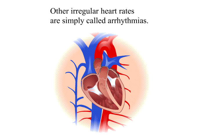 Other irregular heart rates are simply called arrhythmias.