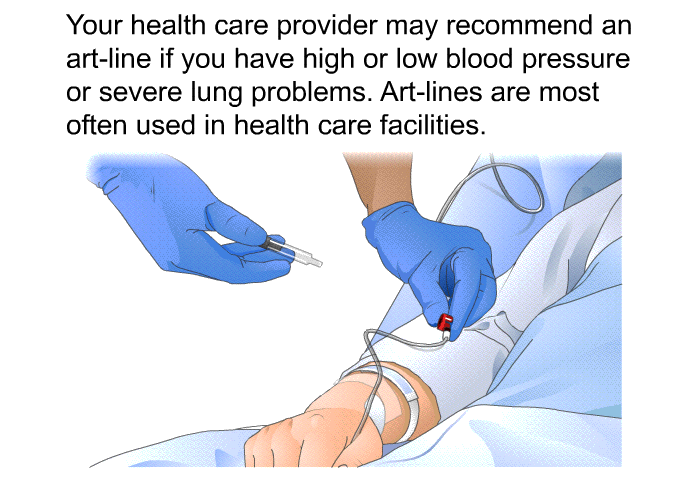 Your health care provider may recommend an art-line if you have high or low blood pressure or severe lung problems. Art-lines are most often used in health care facilities.