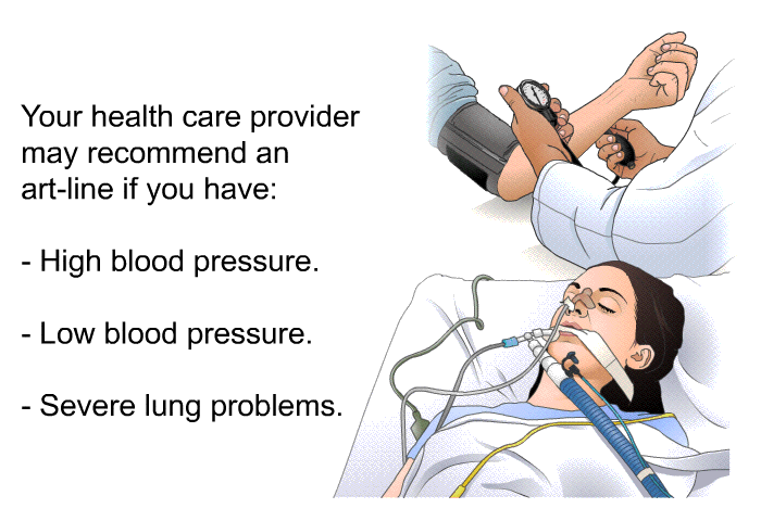 Your health care provider may recommend an art-line if you have:  High blood pressure. Low blood pressure. Severe lung problems.