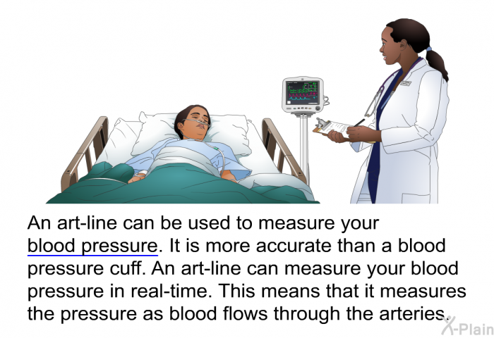 An art-line can be used to measure your blood pressure. It is more accurate than a blood pressure cuff. An art-line can measure you blood pressure in real-time. This means that it measures the pressure as blood flows through the arteries.