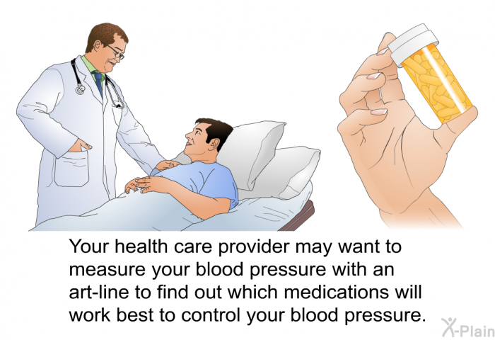 Your health care provider may want to measure your blood pressure with an art-line to find out which medications will work best to control your blood pressure.