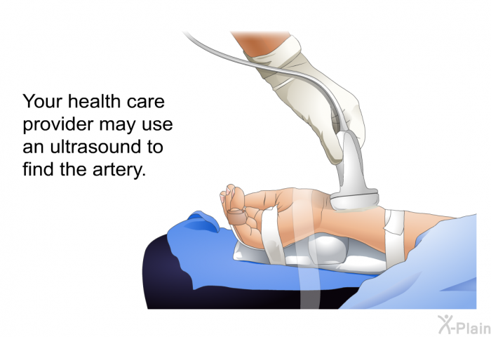Your health care provider may use an ultrasound to find the artery.
