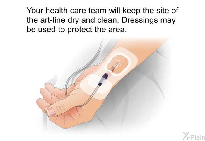 Your health care team will keep the site of the art-line dry and clean. Dressings may be used to protect the area.