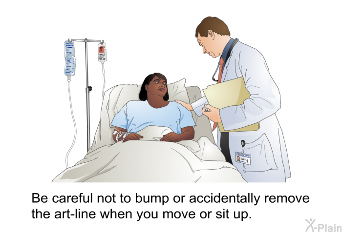 Be careful not to bump or accidentally remove the art-line when you move or sit up.
