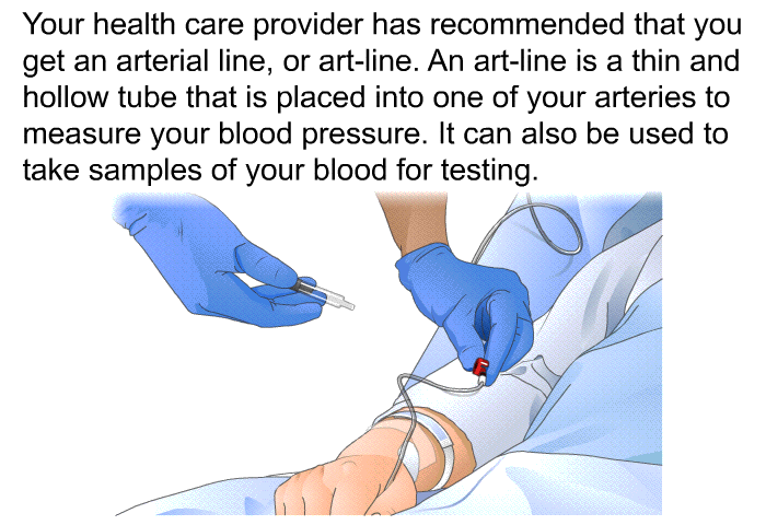 Your health care provider has recommended that you get an arterial line, or art-line. An art-line is a thin and hollow tube that is placed into one of your arteries to measure your blood pressure. It can also be used to take samples of your blood for testing.