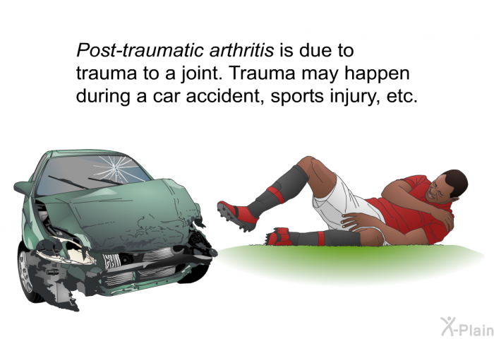 <I>Post-traumatic arthritis</I> is due to trauma to a joint. Trauma may happen during a car accident, sports injury, etc.