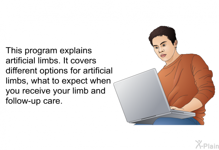 This health information explains artificial limbs. It covers different options for artificial limbs, what to expect when you receive your limb and follow-up care.