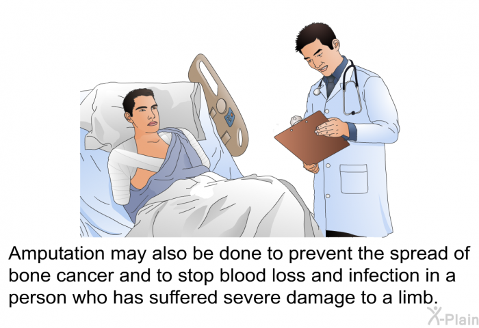Amputation may also be done to prevent the spread of bone cancer and to stop blood loss and infection in a person who has suffered severe damage to a limb.