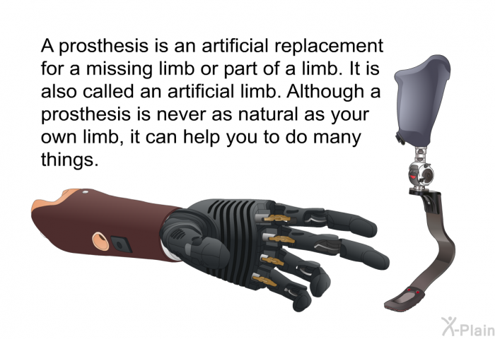 A prosthesis is an artificial replacement for a missing limb or part of a limb. It is also called an artificial limb. Although a prosthesis is never as natural as your own limb, it can help you to do many things.