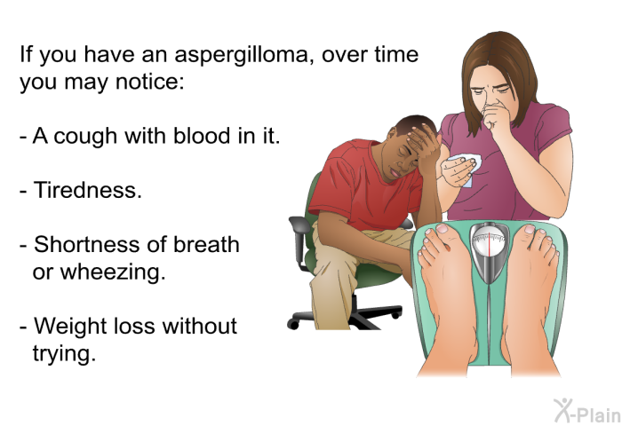 If you have an aspergilloma, over time you may notice:  A cough with blood in it. Tiredness. Shortness of breath or wheezing. Weight loss without trying.