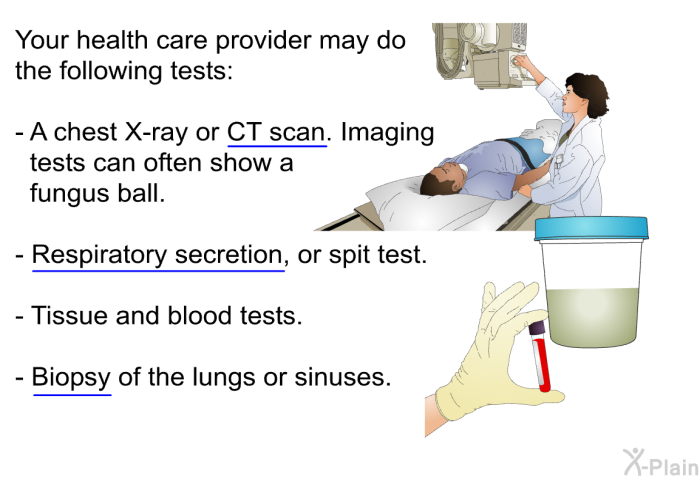 Your health care provider may do the following tests:  A chest X-ray or CT scan. Imaging tests can often show a fungus ball. Respiratory secretion, or spit test. Tissue and blood tests. Biopsy of the lungs or sinuses.