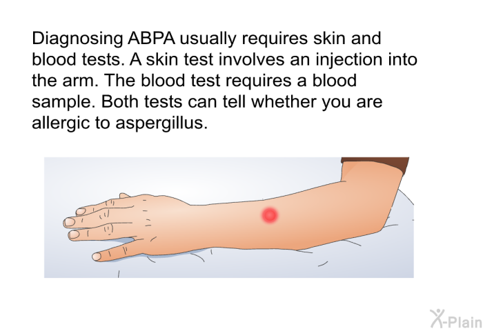 Diagnosing ABPA usually requires skin and blood tests. A skin test involves an injection into the arm. The blood test requires a blood sample. Both tests can tell whether you are allergic to aspergillus.