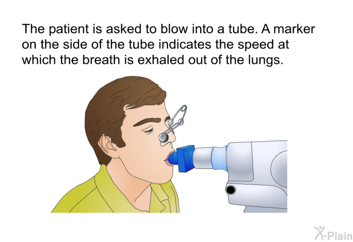 The patient is asked to blow into a tube. A marker on the side of the tube indicates the speed at which the breath is exhaled out of the lungs.