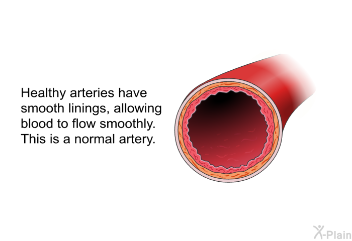 Healthy arteries have smooth linings, allowing blood to flow smoothly. This is a normal artery.
