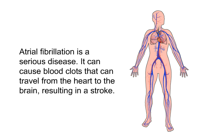 Atrial fibrillation is a serious disease. It can cause blood clots that can travel from the heart to the brain, resulting in a stroke.