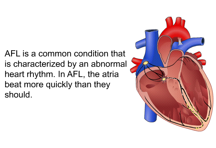 AFL is a common condition that is characterized by an abnormal heart rhythm. In AFL, the atria beat more quickly than they should.