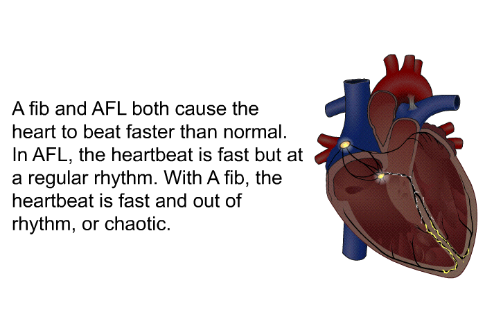 A fib and AFL both cause the heart to beat faster than normal. In AFL, the heartbeat is fast but at a regular rhythm. With A fib, the heartbeat is fast and out of rhythm, or chaotic.