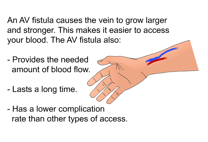 An AV fistula causes the vein to grow larger and stronger. This makes it easier to access your blood. The AV fistula also:  Provides the needed amount of blood flow. Lasts a long time. Has a lower complication rate than other types of access.