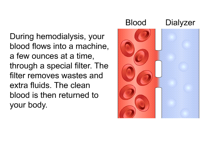 During hemodialysis, your blood flows into a machine, a few ounces at a time, through a special filter. The filter removes wastes and extra fluids. The clean blood is then returned to your body.