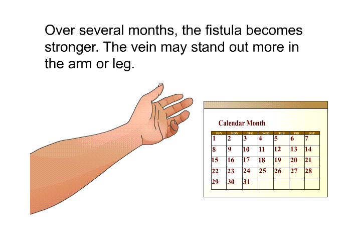 Over several months, the fistula becomes stronger. The vein may stand out more in the arm or leg.