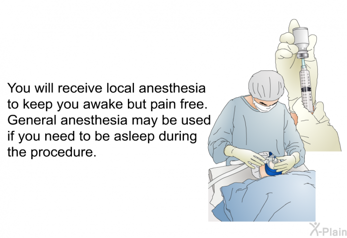 You will receive local anesthesia to keep you awake but pain free. General anesthesia may be used if you need to be asleep during the procedure.