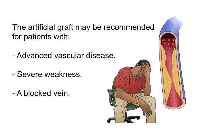 The artificial graft may be recommended for patients with:  Advanced vascular disease. Severe weakness. A blocked vein.