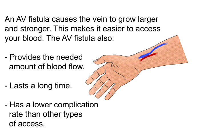 An AV fistula causes the vein to grow larger and stronger. This makes it easier to access your blood. The AV fistula also:  Provides the needed amount of blood flow. Lasts a long time. Has a lower complication rate than other types of access.
