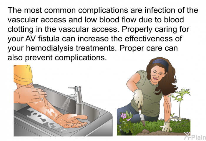 The most common complications are infection of the vascular access and low blood flow due to blood clotting in the vascular access. Properly caring for your AV fistula can increase the effectiveness of your hemodialysis treatments. Proper care can also prevent complications.
