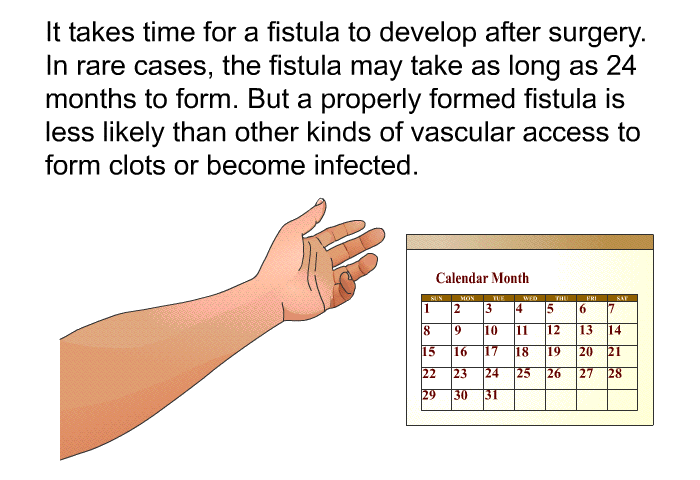 It takes time for a fistula to develop after surgery. In rare cases, the fistula may take as long as 24 months to form. But a properly formed fistula is less likely than other kinds of vascular access to form clots or become infected.