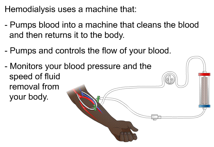 Hemodialysis uses a machine that:  Pumps blood into a machine that cleans the blood and then returns it to the body. Pumps and controls the flow of your blood. Monitors your blood pressure and the speed of fluid removal from your body.