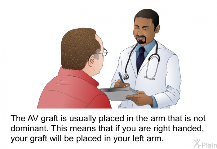 The AV graft is usually placed in the arm that is not dominant. This means that if you are right handed, your graft will be placed in your left arm.