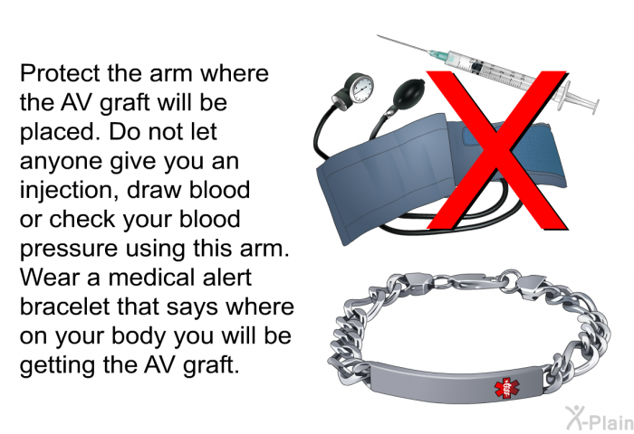 Protect the arm where the AV graft will be placed. Do not let anyone give you an injection, draw blood or check your blood pressure using this arm. Wear a medical alert bracelet that says where on your body you will be getting the AV graft.