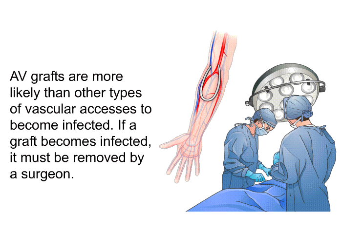 AV grafts are more likely than other types of vascular accesses to become infected. If a graft becomes infected, it must be removed by a surgeon.