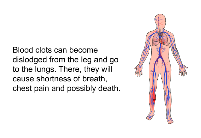 Blood clots can become dislodged from the leg and go to the lungs. There, they will cause shortness of breath, chest pain and possibly death.