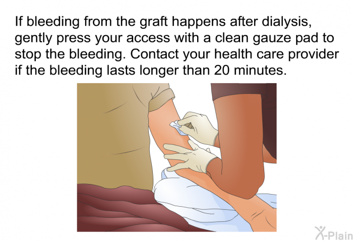 If bleeding from the graft happens after dialysis, gently press your access with a clean gauze pad to stop the bleeding. Contact your health care provider if the bleeding lasts longer than 20 minutes.