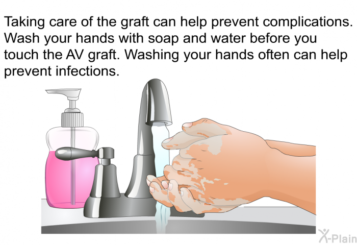 Taking care of the graft can help prevent complications. Wash your hands with soap and water before you touch the AV graft. Washing your hands often can help prevent infections.