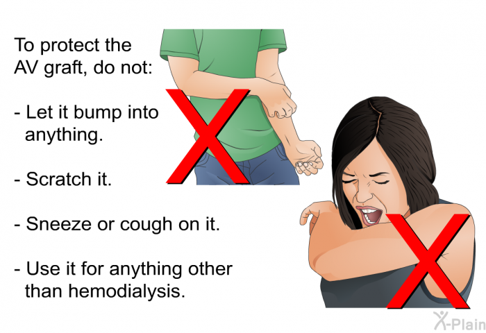 To protect the AV graft, do not:  Let it bump into anything. Scratch it. Sneeze or cough on it. Use it for anything other than hemodialysis.