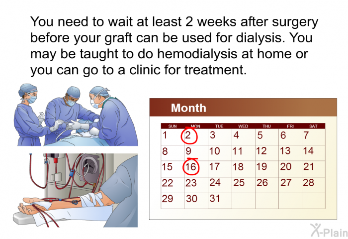 You need to wait at least 2 weeks after surgery before your graft can be used for dialysis. You may be taught to do hemodialysis at home or you can go to a clinic for treatment.
