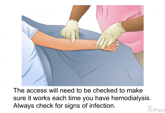 The access will need to be checked to make sure it works each time you have hemodialysis. Always check for signs of infection.