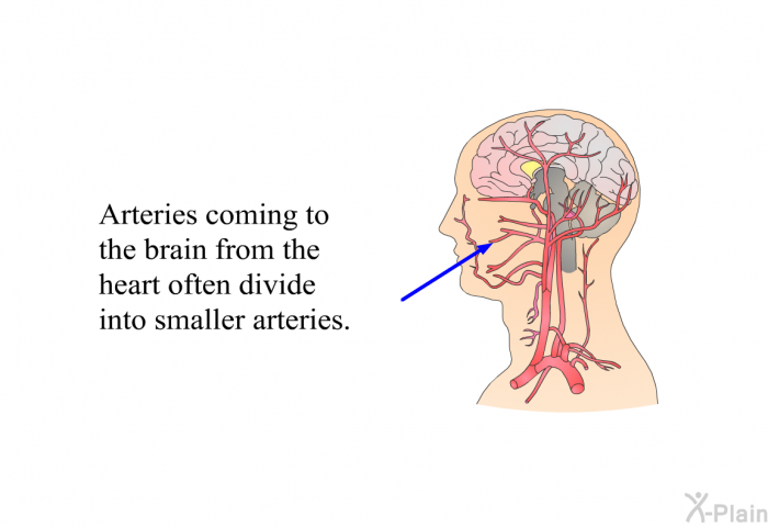 Arteries coming to the brain from the heart often divide into smaller arteries.