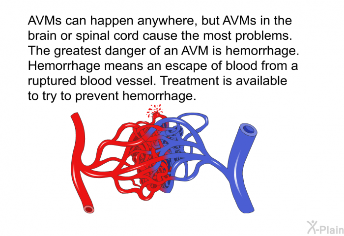 AVMs can happen anywhere, but AVMs in the brain or spinal cord cause the most problems. The greatest danger of an AVM is hemorrhage. Hemorrhage means an escape of blood from a ruptured blood vessel. Treatment is available to try to prevent hemorrhage.