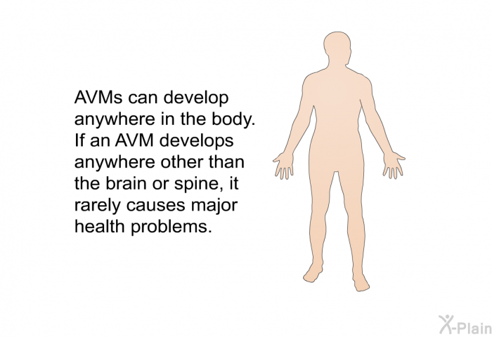 AVMs can develop anywhere in the body. If an AVM develops anywhere other than the brain or spine, it rarely causes major health problems.