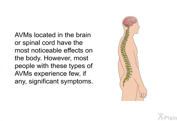 AVMs located in the brain or spinal cord have the most noticeable effects on the body. However, most people with these types of AVMs experience few, if any, significant symptoms.