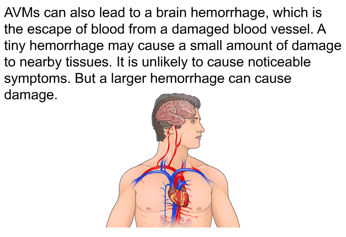 AVMs can also lead to a brain hemorrhage, which is the escape of blood from a damaged blood vessel. A tiny hemorrhage may cause a small amount of damage to nearby tissues. It is unlikely to cause noticeable symptoms. But a larger hemorrhage can cause damage.