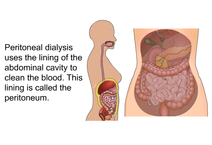 Peritoneal dialysis uses the lining of the abdominal cavity to clean the blood. This lining is called the peritoneum.