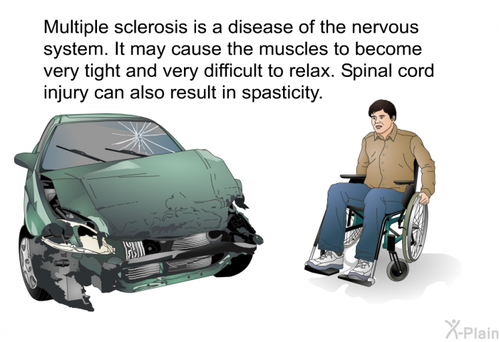 Multiple sclerosis is a disease of the nervous system. It may cause the muscles to become very tight and very difficult to relax. Spinal cord injury can also result in spasticity.