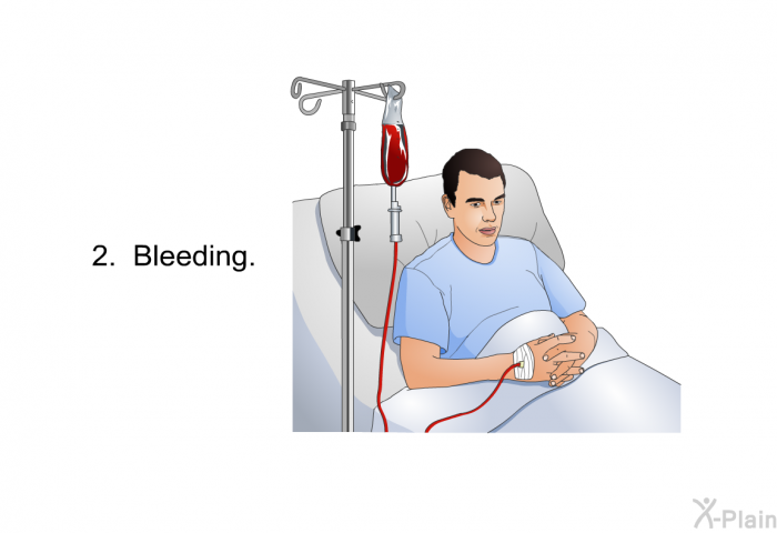 Bleeding.