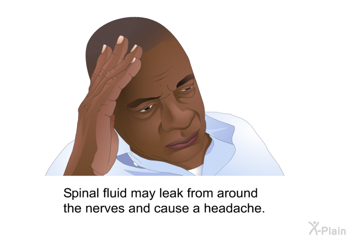 Spinal fluid may leak from around the nerves and cause a headache.